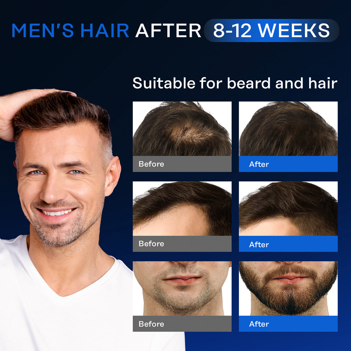 Mega Hair Growth Serum for Men and Women
