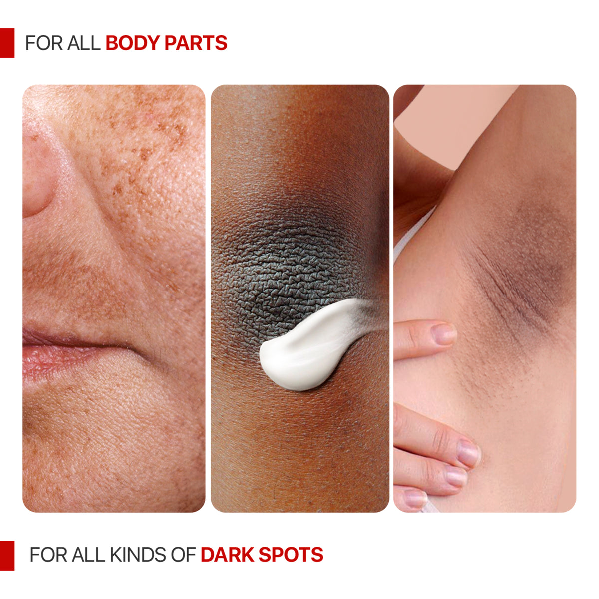 Vitaminized Dark Spot Corrector Sale for Face, Skin, Body, and Legs